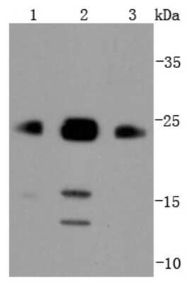Western Blot: Bim Antibody (SU0318) [NBP2-67456]