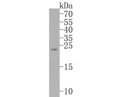 Western Blot: Bim Antibody (SU0318) [NBP2-67456]