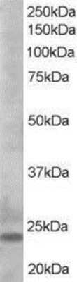 Western Blot: Bim Antibody [NB100-1440]