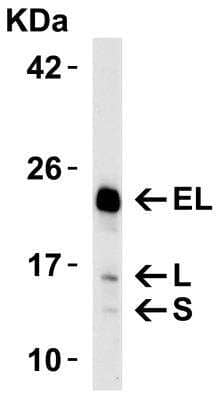 Western Blot: Bim AntibodyBSA Free [NBP1-76963]