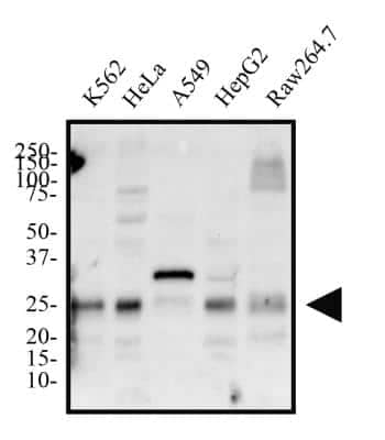 Western Blot: Bim Antibody [NBP2-53088]