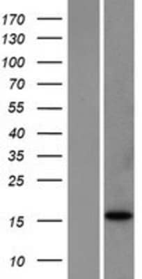 Western Blot: Bim Overexpression Lysate [NBP2-10405]