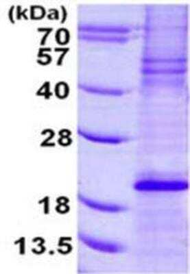 SDS-PAGE: Recombinant Human Bim His Protein [NBP1-98873]