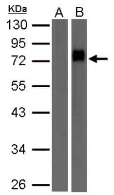 Western Blot: Biotin Antibody [NBP2-15589]