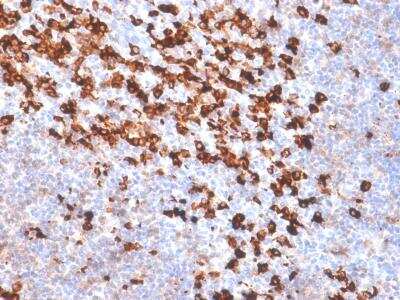 Immunohistochemistry-Paraffin: Biotin (Vitamin B7 or Vitamin H) Antibody (BTN/2032R) - Azide and BSA Free [NBP2-61393]