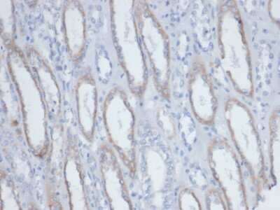 Immunohistochemistry-Paraffin: Biotin (Vitamin B7 or Vitamin H) Antibody (BTN/403) [NBP3-13904]