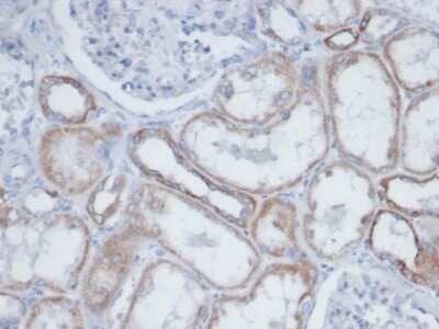 Immunohistochemistry-Paraffin: Biotin (Vitamin B7 or Vitamin H) Antibody (BTN399) [NBP3-13901]