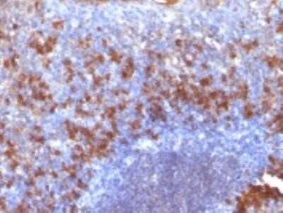 Immunohistochemistry-Paraffin: Biotin (Vitamin B7 or Vitamin H) Antibody (SPM375) - Azide and BSA Free [NBP2-34771]