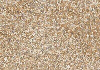 Immunohistochemistry-Paraffin: Biotinidase/BTD Antibody (006) [NBP2-90315]