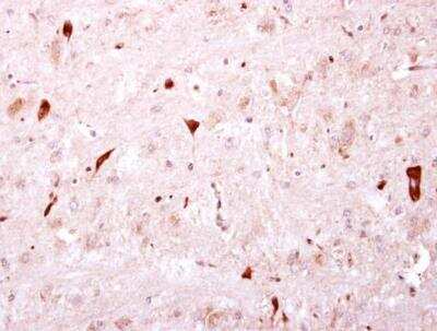 Immunohistochemistry-Paraffin: Biotinidase/BTD Antibody [NBP2-14891]