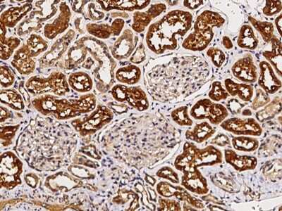 Immunohistochemistry-Paraffin: Biotinidase/BTD Antibody [NBP2-97093]