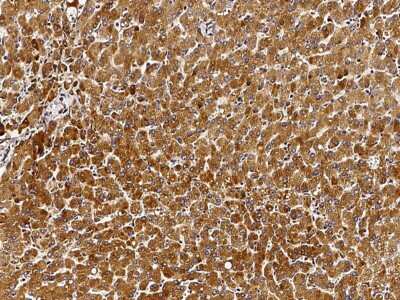 Immunohistochemistry-Paraffin: Biotinidase/BTD Antibody [NBP2-97093]