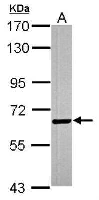 Western Blot: Biotinidase/BTD Antibody [NBP2-14891]