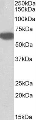 Western Blot: Biotinidase/BTD Antibody [NBP2-26186]