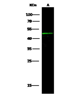 Western Blot: Biotinidase/BTD Antibody [NBP2-97093]