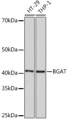 Western Blot: Blood Group B Transferase/GTB/ABO Antibody (2V4R0) [NBP3-16589]