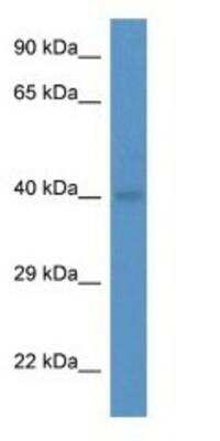 Western Blot: Blood Group B Transferase/GTB/ABO Antibody [NBP1-74152]