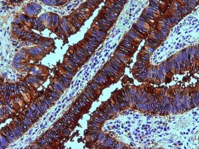 Immunohistochemistry: Fucosyltransferase 3/FUT3 Antibody (2-25LE) - BSA Free [NB500-526]