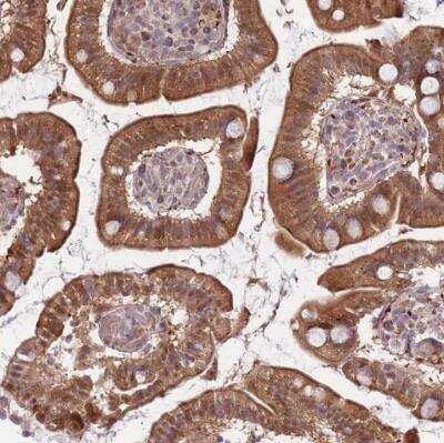 Immunohistochemistry-Paraffin: Fucosyltransferase 3/FUT3 Antibody [NBP2-54732]