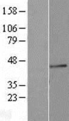 Western Blot: Fucosyltransferase 3/FUT3 Overexpression Lysate [NBL1-10865]