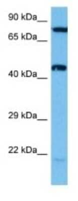 Western Blot: Fucosyltransferase 1/FUT1 Antibody [NBP3-10979]