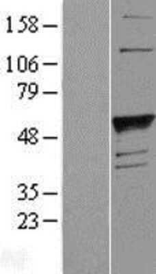 Western Blot: Fucosyltransferase 1/FUT1 Overexpression Lysate [NBL1-10863]