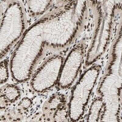 Immunohistochemistry-Paraffin: Blooms Syndrome Protein Blm Antibody [NBP1-89929]