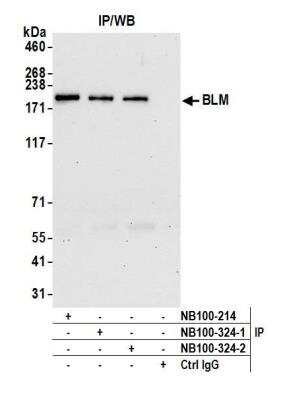 Immunoprecipitation: Blooms Syndrome Protein Blm Antibody [NB100-324]