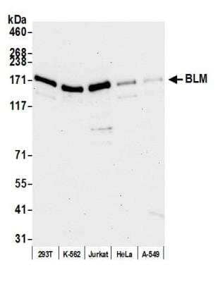 Western Blot: Blooms Syndrome Protein Blm Antibody [NB100-214]