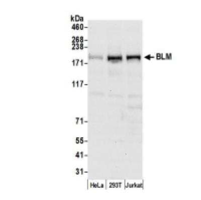 Western Blot: Blooms Syndrome Protein Blm Antibody [NB100-324]