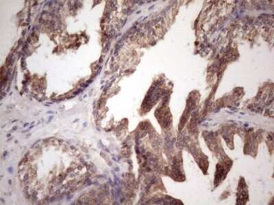 Immunohistochemistry: Bmf Antibody (OTI6F3) - Azide and BSA Free [NBP2-72311]