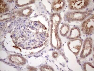 Immunohistochemistry: Bmf Antibody (OTI6F3) - Azide and BSA Free [NBP2-72311]
