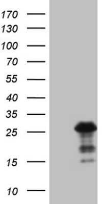 Western Blot: Bmf Antibody (OTI6F3)Azide and BSA Free [NBP2-72311]