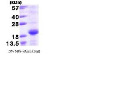 SDS-PAGE: Recombinant Human Bmf T7 Protein [NBC1-28000]