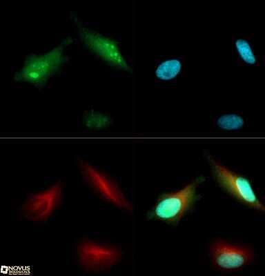 Immunocytochemistry/ Immunofluorescence: BMI-1 Antibody [NB110-40823]