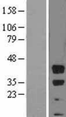 Western Blot: BMI-1 Overexpression Lysate [NBL1-07997]