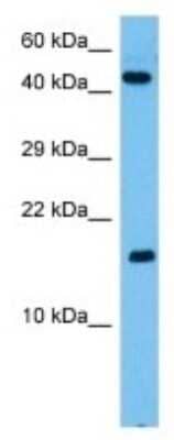 Western Blot: Bmyc Antibody [NBP3-10157]