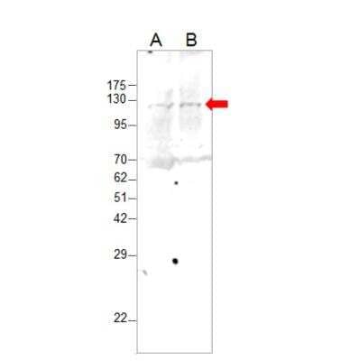 Western Blot: BoNT-A Light Chain Antibody [NBP3-12385]