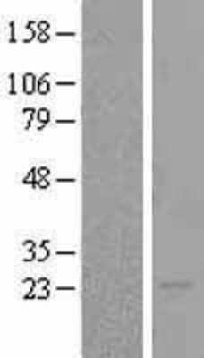 Western Blot: BOK Overexpression Lysate [NBL1-08017]