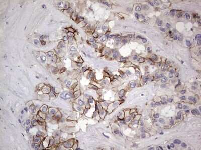 Immunohistochemistry: Boll Antibody (OTI2D11) [NBP2-46582]