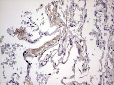 Immunohistochemistry: Boll Antibody (OTI2D11) [NBP2-46582]