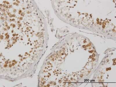 Immunohistochemistry-Paraffin: Boll Antibody (2E8) [H00066037-M06]