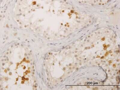 Immunohistochemistry-Paraffin: Boll Antibody (3E10) [H00066037-M03]