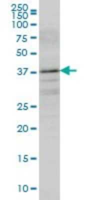 Western Blot: Boll Antibody (5B8) [H00066037-M05]