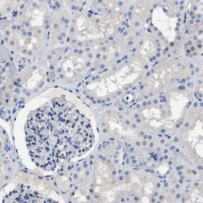 Immunohistochemistry-Paraffin: Boll Antibody [NBP1-88377]