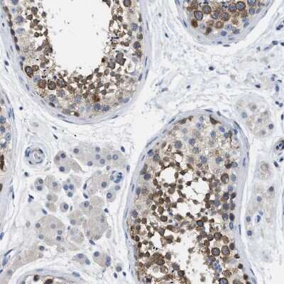 Immunohistochemistry-Paraffin: Boll Antibody [NBP1-88377]