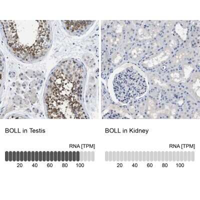 Immunohistochemistry-Paraffin: Boll Antibody [NBP1-88377]
