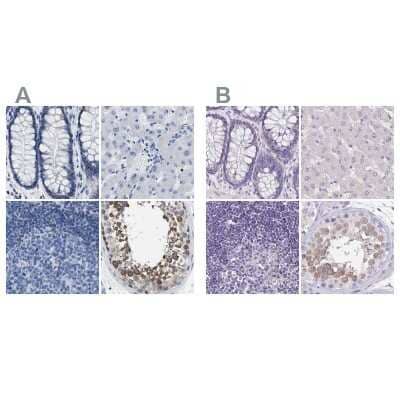 Immunohistochemistry-Paraffin: Boll Antibody [NBP1-88377]