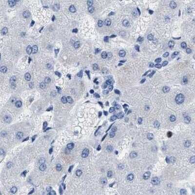 Immunohistochemistry-Paraffin: Boll Antibody [NBP1-88377]