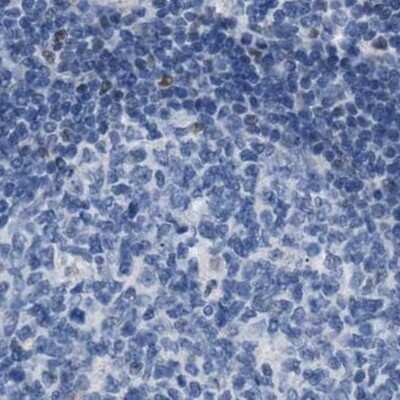 Immunohistochemistry-Paraffin: Boll Antibody [NBP1-88377]